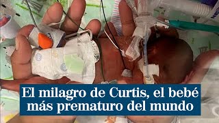 El milagro de Curtis el bebé más prematuro del mundo que pesó 420 gramos [upl. by Wei]