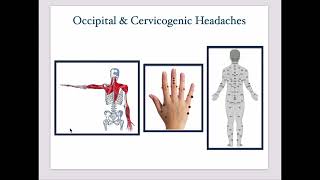 Master Tungs Points for Occipital Headaches [upl. by Atilam]