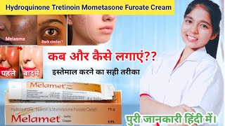 Hydroquinone tretinoin mometasone furoate cream  Melamet Cream Ki Jankari  Drx Pranjali Satpute [upl. by Tamqrah225]