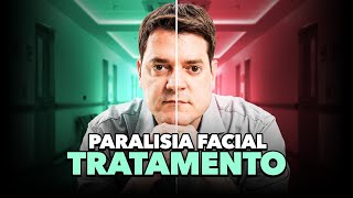 Paralisia Facial de Bell  Qual o Melhor Tratamento [upl. by Enelyk]