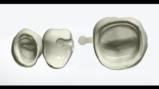 Split Bridge with Male amp Female Connector 3Shape Dental System 1540 [upl. by Edna562]