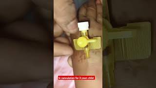 IV cannulation procedure children shorts trending video drxsachin12 [upl. by Atisusej617]