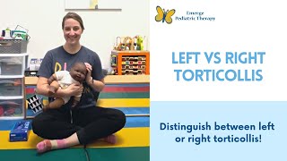 Left or Right Torticollis [upl. by Blandina]