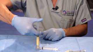 Watch Dr Patrick Tonnard Prepping TRUE NanoFat [upl. by Traci882]