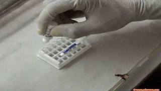 Rapid malaria test [upl. by Gradey]