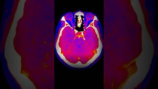 Neanderthal Brains Were Different [upl. by Hgielanna]