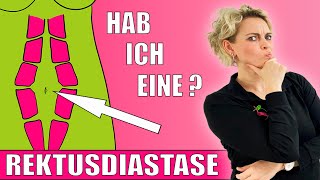 5 💜Anzeichen einer Rektusdiastase💜Wie erkenne ich ob ich eine Rectusdiastase habe💜habe ich eine💜 [upl. by Thorne215]