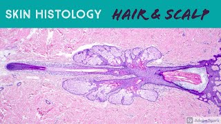 Hair follicle under microscope amp scalp skin histology dermatology dermpath pathology anatomy [upl. by Hightower]