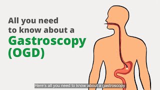 Gastroscopy OGD What is it for and what should I expect [upl. by Alehc386]