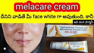 melacare cream in telugu  uses how to apply precautions sideeffects etc melasma [upl. by Bone]