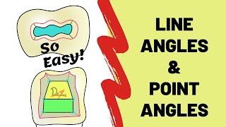 Line Angles and Point Angles in Cavity Preparation [upl. by Fronniah]