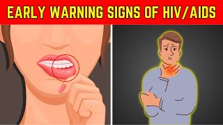 Identify The Early Signs Of HIV AIDS  10 Signs Of HIV Positive [upl. by Hcardahs]