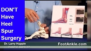 Heel Spur Treatment – How to Avoid Heel Spur Surgery  Seattle Podiatrist [upl. by Retsae493]