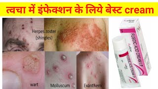 best cream for skin infection  fucidin cream  fucidin cream for acne  fusidic acid cream [upl. by Eerehs]