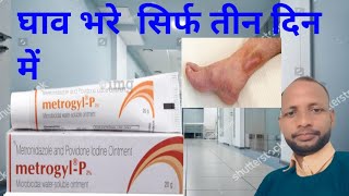 metrogyl p ke phaydeuseghav bharne ki cream kisi bhi prakar ki ghav [upl. by Sela585]