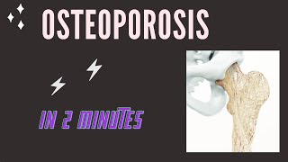 Osteoporosis in 2 mins [upl. by Kcerb877]