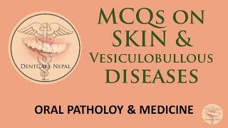 MCQs on Skin and Vesiculobullous Diseases  Oral Patholody and Medicine [upl. by Ettenajna]