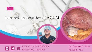 Laparoscopic excision of ACUM Kewal Hospital  Laparoscopy Training [upl. by Raynell214]