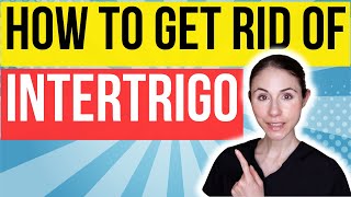 How To Get Rid Of Intertrigo FAST  Dermatologist Tips [upl. by Ynnahc]