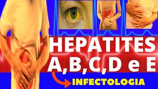 HEPATITES A B C D e E  CARACTERÍSTICAS SINTOMAS DIAGNÓSTICO E TRATAMENTO  INFECTOLOGIA [upl. by Aicac]