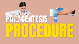 Paracentesis procedure  Paracentesis procedure full video explanation [upl. by Gilliam]