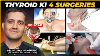 My Reaction To Different Types of Minimally Invesive Thyroid Surgeries  Dr Gaurav Gangwani IR [upl. by Atsirtal906]