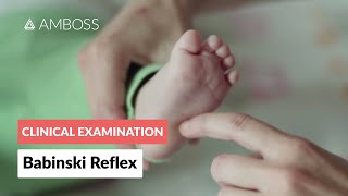 Babinski Reflex in Infants  Clinical Examination [upl. by Enilec]