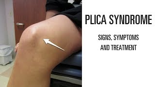 Plica syndrome Signs symptoms and treatment of this uncomfortable knee pain [upl. by Malone]