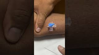 IV cannula insertiondocternursingmotivationviralvideoshortvideo [upl. by Ynahirb]