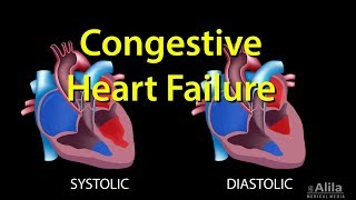 Congestive Heart Failure Leftsided vs Rightsided Systolic vs Diastolic Animation [upl. by Nezam]