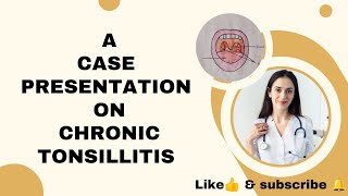 case presentation on CHRONIC TONSILLITIS  MGM MEDICAL COLLEGE KISHANGANJBIHAR msn bscnursing [upl. by Atok]