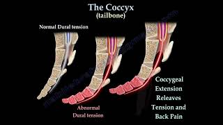 Coccydynia  coccyx pain coccyx pain causes diagnosis and treatment [upl. by Wonacott]