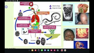 NEMATODOS Enterovius trichuris Ascaris Strongyloides Uncinarias Filariasis Oncocercosisetc💀🧫 [upl. by Eixid]