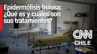 Dolorosa enfermedad Los tratamientos para la epidermólisis bulosa [upl. by Anirda]