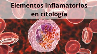 Elementos inflamatorios en citología Glóbulos blancos Leucocitos [upl. by Attemaj247]