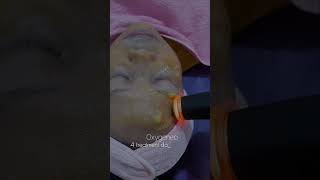 Oxygeneo Treatment skincare funny perawatanwajah facial [upl. by Ymiaj]