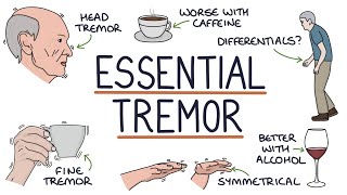 Understanding Benign Essential Tremor [upl. by Avat471]