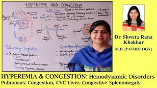 HYPEREMIA amp CONGESTION Pulmonary Congestion  CVC Liver  Congestive Splenomegaly [upl. by Roselani]