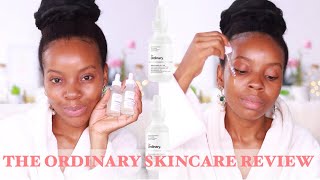 The Ordinary Skincare Review  Niacinamide 10 Zinc 1 and Alpha Arbutin 2  HAacne prone skin WOC [upl. by Chemarin]