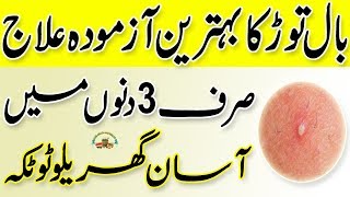 Boils Treatment At Home  Bal Tor Ka Ilaj In Urdu  Boils Ka Ilaj In Urdu  Health Tips [upl. by Ivanah]