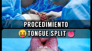 😝 TONGUE SPLITLENGUA BIFIDA 👅 [upl. by Tiffanle]