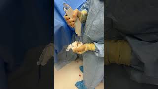 Orthopedic surgery operationtheatre operationtheatretechnician orthopedics shorts [upl. by Ayamat]