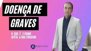 Doença de Graves O que é e como afeta a sua tireoide  Dr Rogério Leite [upl. by Eatnuahs]