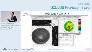 Prof Fritz Hengerer Tomographie und optische Biometrie mit der Pentacam® AXL [upl. by Faxon410]