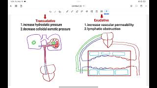 Pleural Effusion Causes investigationTreatment [upl. by Valentino596]