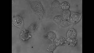 Nanodiscs destroy cancer cells [upl. by Regni]