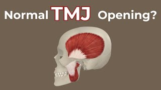 Health VS Click VS Limited Opening Series Part 1 Healthy TMJ [upl. by Zandra]