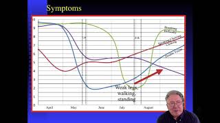 Myasthenia Gravis MG  What to expect [upl. by Ahtan]