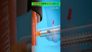 How Does The EpiPen Work Close Up epipen youtube shorts [upl. by Sirk286]