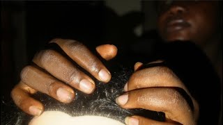 ASMR Greasing Oiling and Scratching Your Scalp [upl. by Onahpets921]